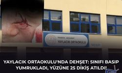 YAYLACIK ORTAOKULU'NDA DEHŞET: SINIFI BASIP YUMRUKLADI, YÜZÜNE 25 DİKİŞ ATILDI!