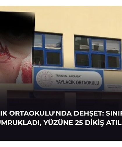 YAYLACIK ORTAOKULU'NDA DEHŞET: SINIFI BASIP YUMRUKLADI, YÜZÜNE 25 DİKİŞ ATILDI!