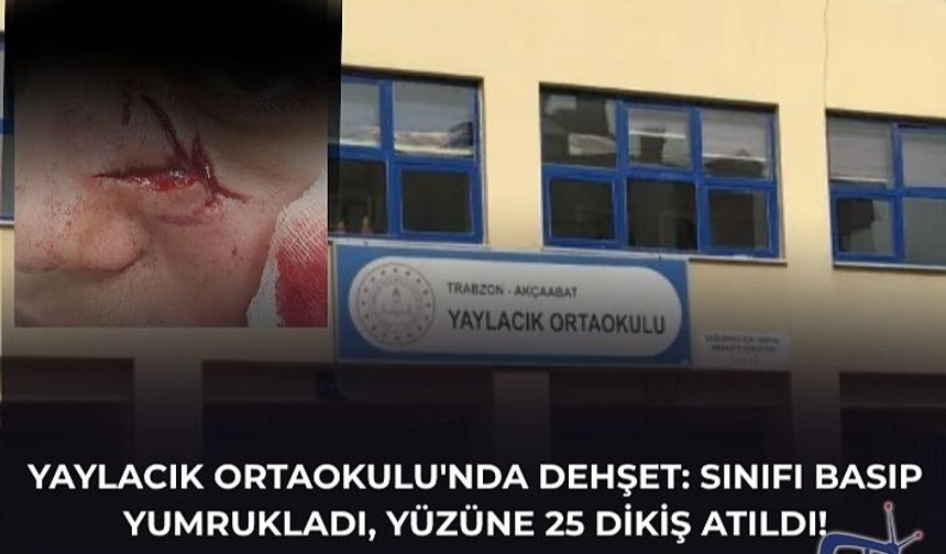 YAYLACIK ORTAOKULU'NDA DEHŞET: SINIFI BASIP YUMRUKLADI, YÜZÜNE 25 DİKİŞ ATILDI!